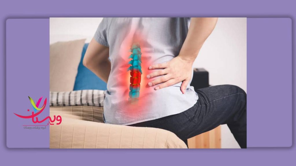 تدابیر درمانی برای درد سیاتیک راهکارهای پیشنهادی برای درد بیماری عصب سیاتیک