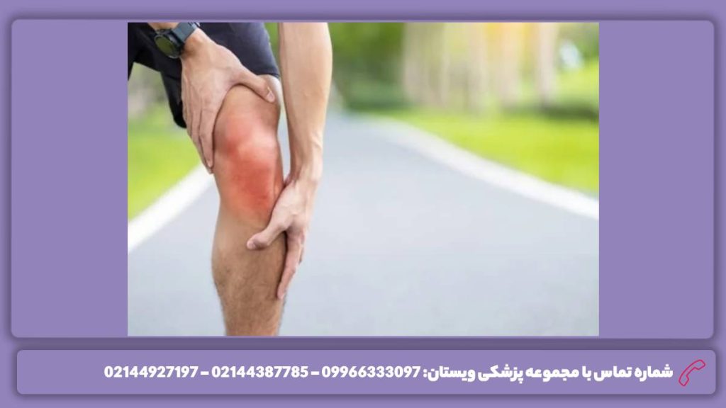 زمان مراجعه به متخصص مراجعه ضروری به دکتر درد عضله و ماهیچه