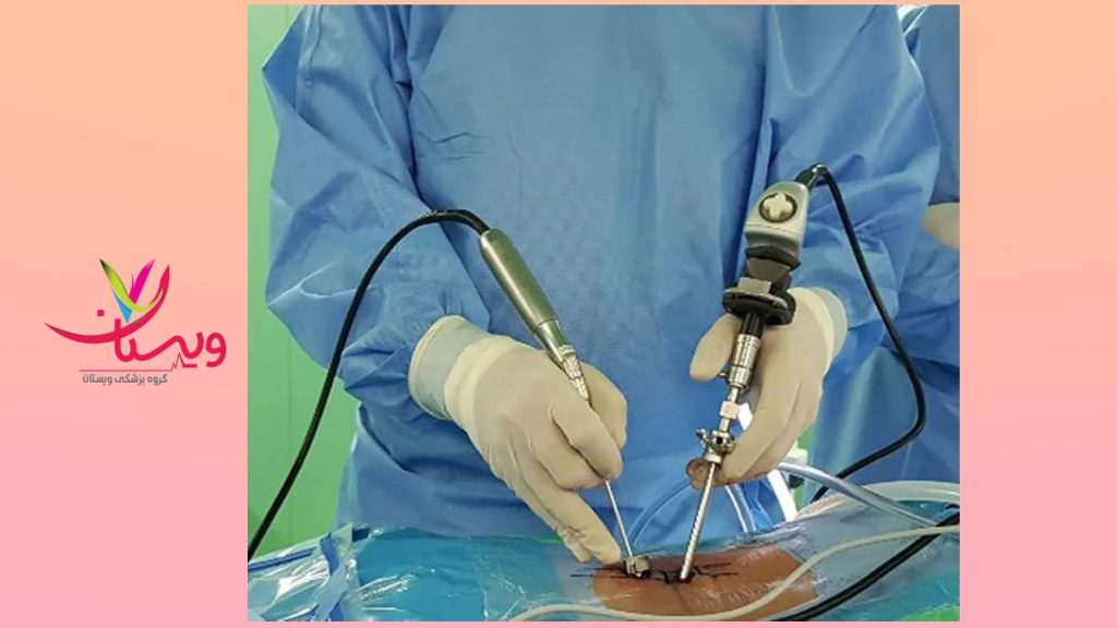 سبک زندگی بعد از درمان جراحی زندگی کردن بعد از عمل جراحی دیسک بینمهرهای