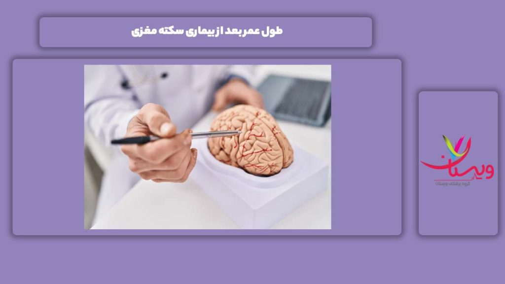 طول عمر بعد از بیماری سکته مغزی طول عمر بعد از بیماری سکته مغزی
