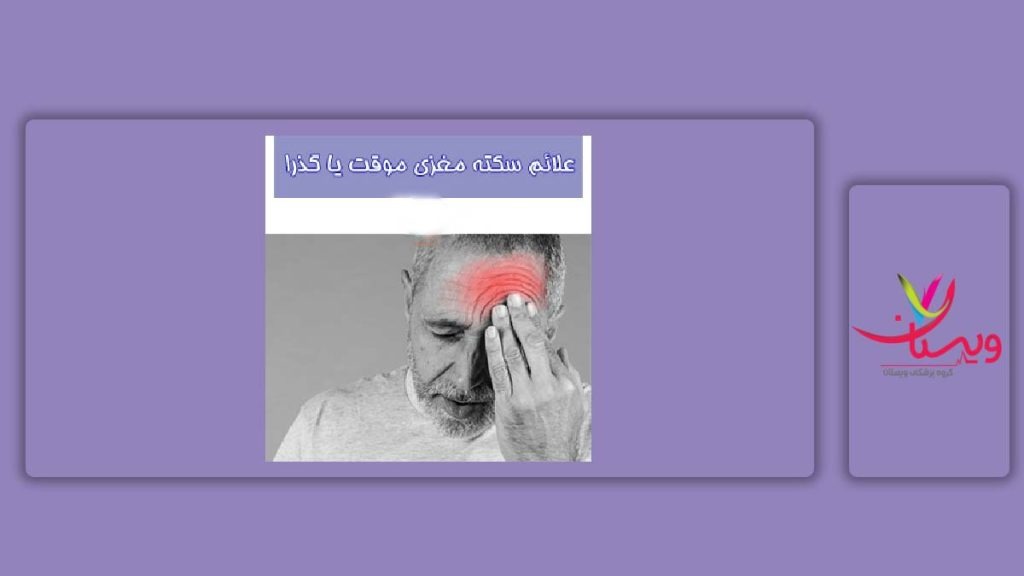 علائم سکته مغزی گذرا سکته مغزی گذرا