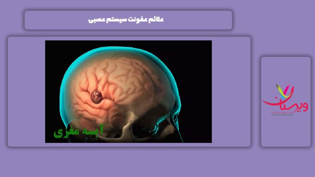 نشانههای عفونت عصبی علائم عفونت عصبی