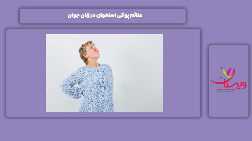 نشانه پوکی استخوان در زنهای جوان نشانههای پوکی استخوان در زنان جوان