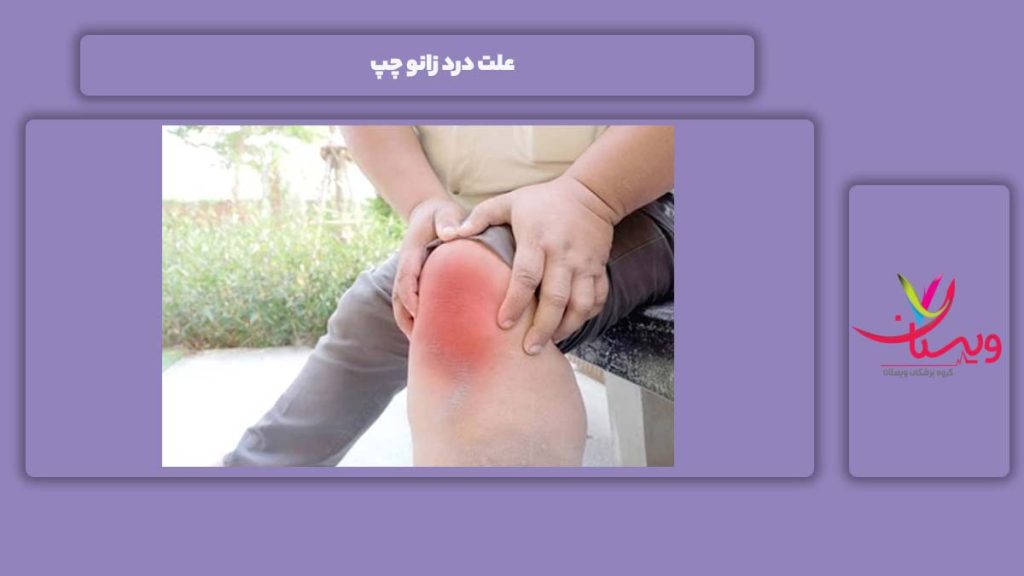 نشانه درد در زانوی چپ علت زانو درد چپ