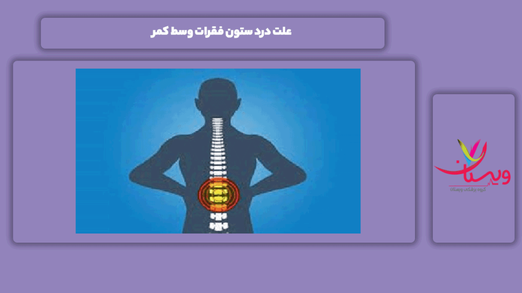 عارضه درد ستون فقرات وسط کمر دلیل درد در ستون فقرات وسط کمر