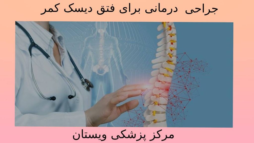 عمل فتق دیسک در ویستان انجام عمل جراحی اصلاحی مهرههای کمری در تهران