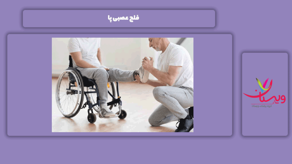 فلج عصبی پاها فلج عصب پا