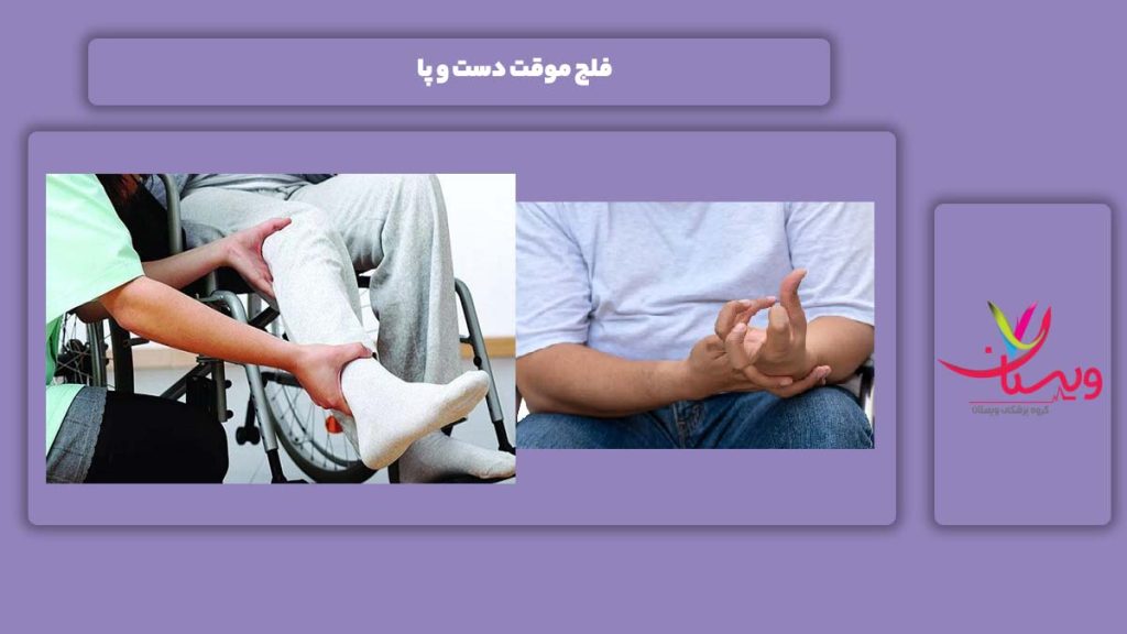 فلج محدود دست و پا موقت فلج بودن دست و پا