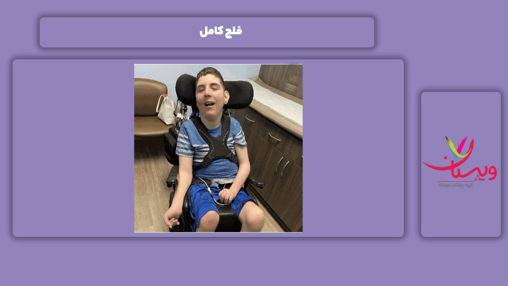 فلج شدن تمامی اعضای بدن فلج شدن کامل اعضای و جوارح بدن