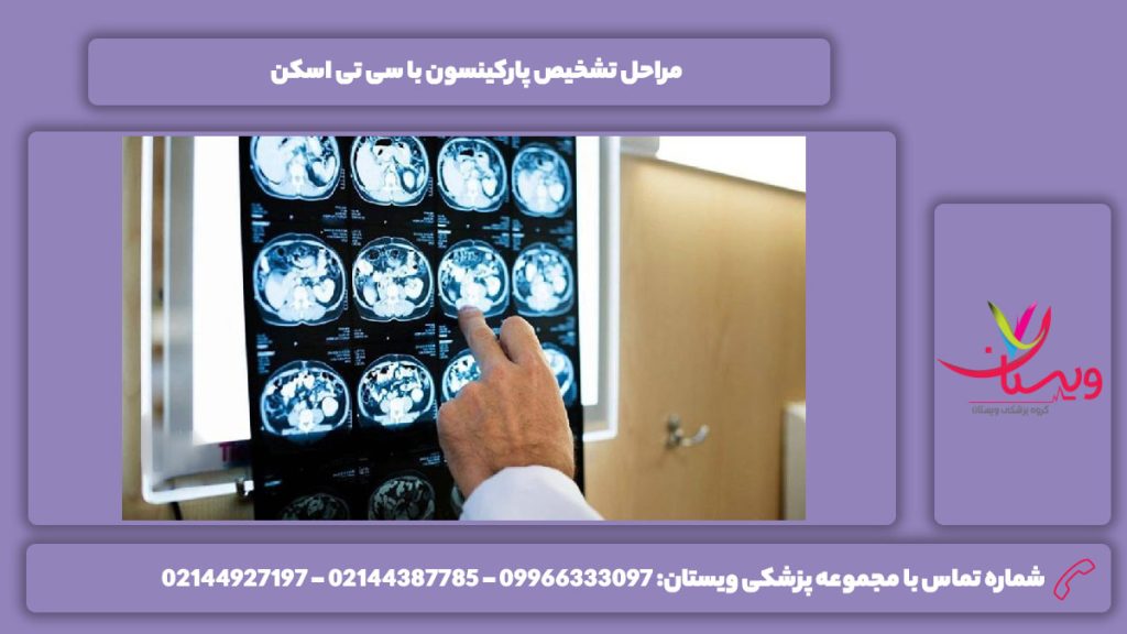 فازهای تشخیص پارکینسون با سی تی اسکن تشخیص پارکینسون با سی تی اسکن