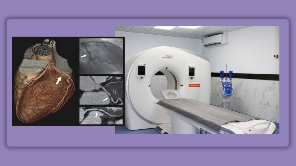 سی تی آنژیوی قلب گروه ویستان هزینه سی تی آنژیوگرافی قلب در مراکز معتبر