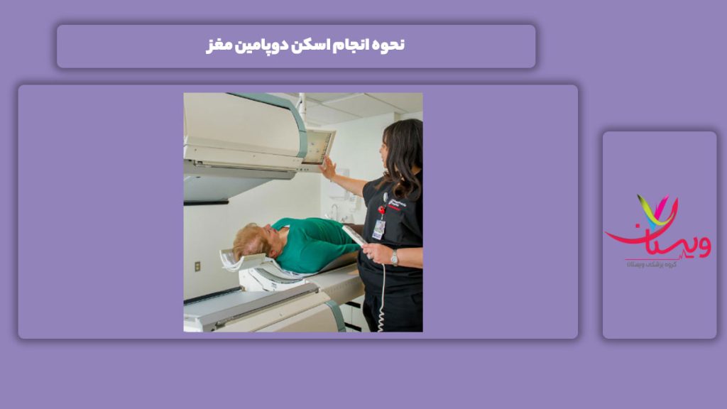 چگونگی انجام اسکن دوپامین مغز نحوه انجام اسکن دوپامین مغز