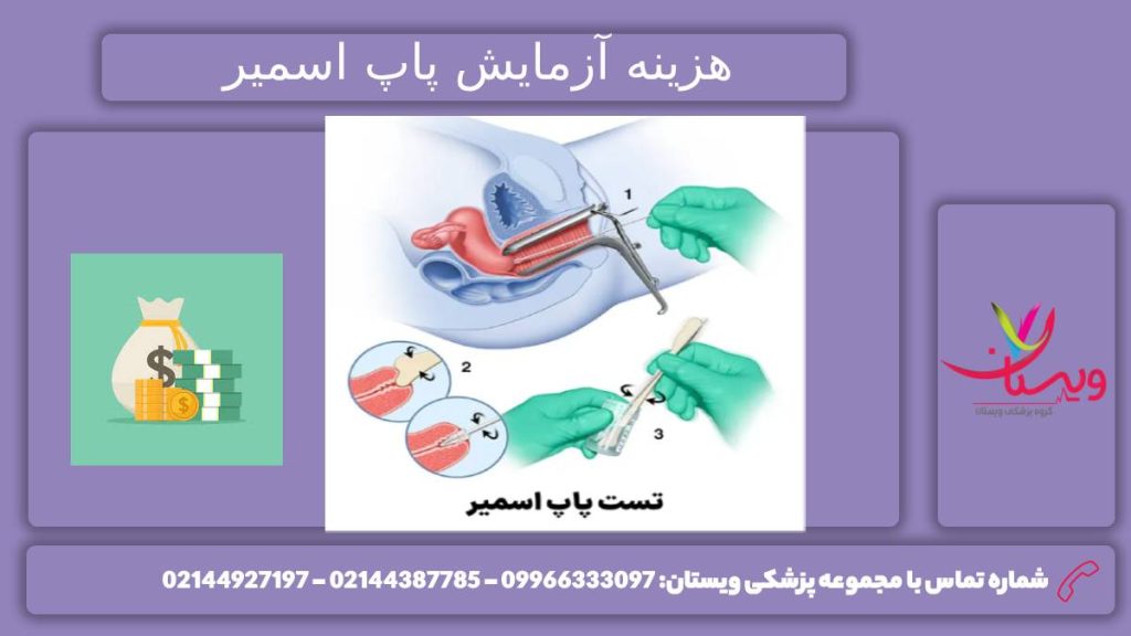 برسی هزینه آزمایش پاپ اسمیر