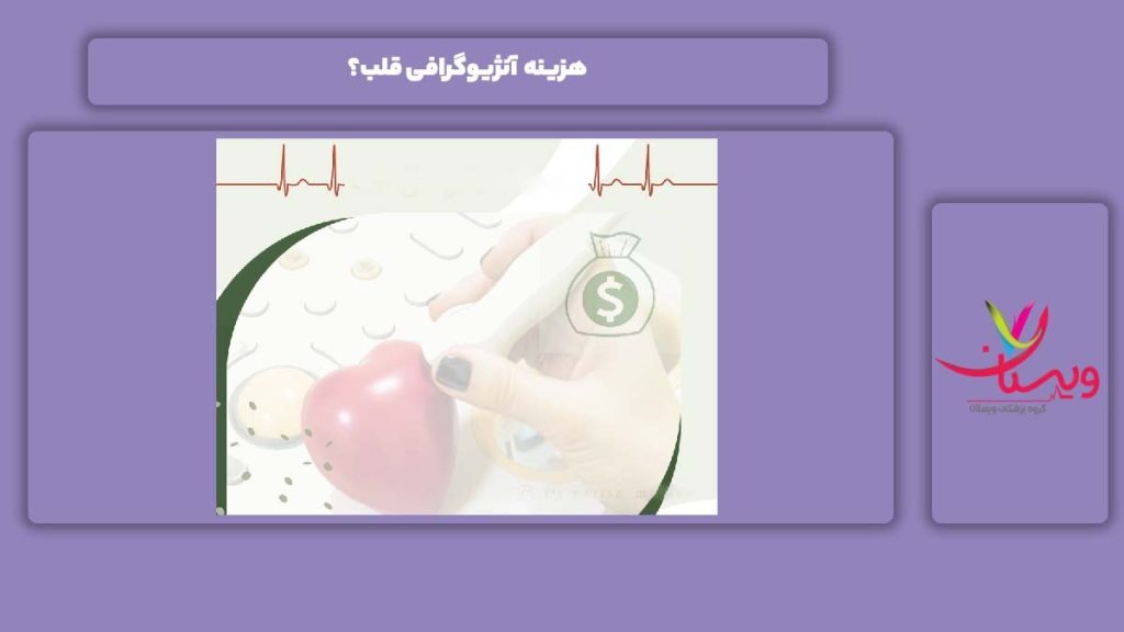 قیمت انجام آنژیو قلب هزینه آنژیوگرافی قلب؟