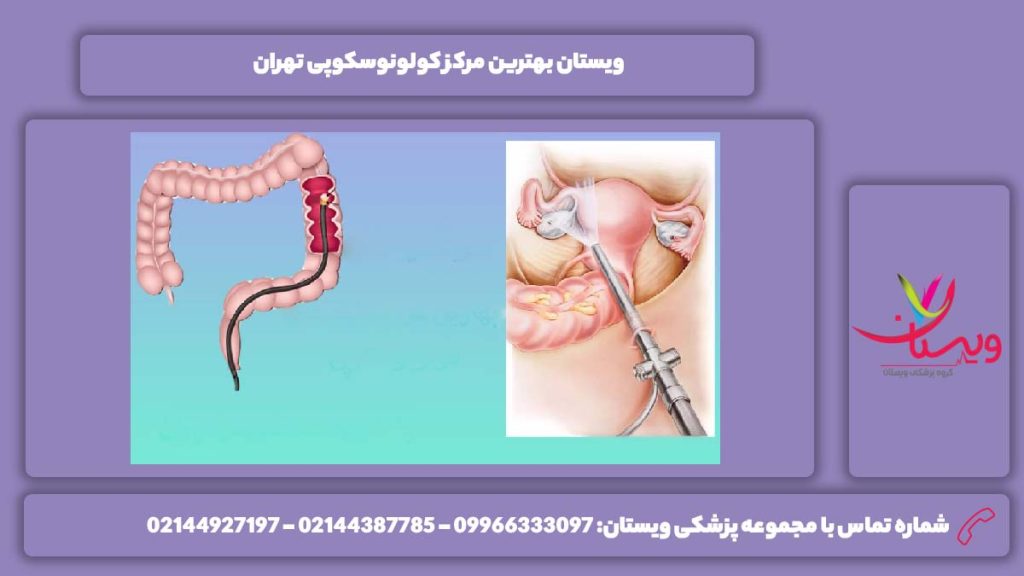 ویستان خوبترین مرکز برای انجام کولونوسکوپی بهترین مرکز کولونوسکوپی تهران