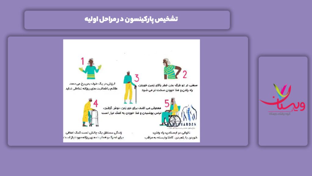 تشخیص سریع بیماری پارکینسون شناسایی علائم اولیه برای کنترل بیماری پارکینسون
