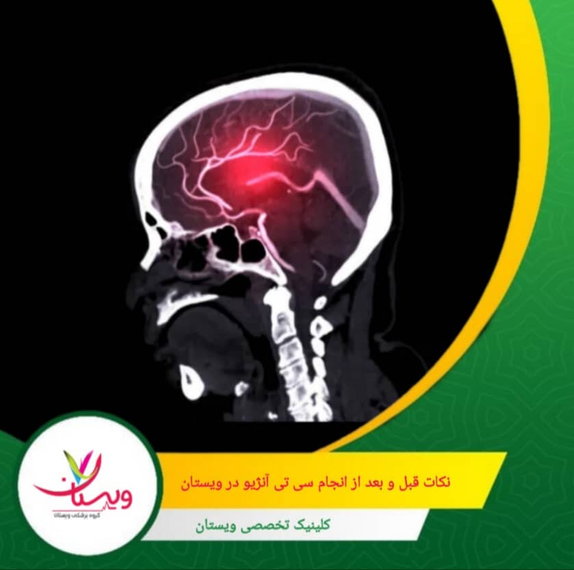 این روش علاوه بر کمتهاجمی بودن، جایگزین امنی برای آنژیوگرافیهای قدیمی با کاتتر است و بهطور چشمگیری زمان و هزینه را کاهش میدهد . سی تی آنژیوگرافی مغز: تعریفی سریع و کاربردها