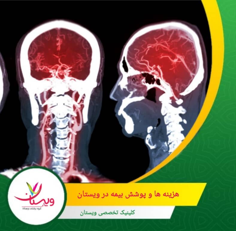 قرار دادن خط وریدی (IV) و تزریق ماده حاجب ـ معمولاً با دستگاههای اتومات (power injector) برای ثبت تصاویر سهبعدی دقیق مراحل کلینیک ویستان: از نوبتگیری تا انجام سی تی آنژیو