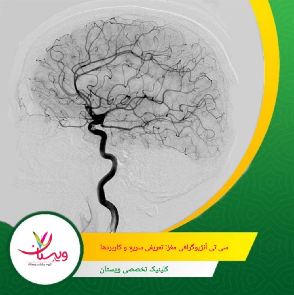 پیگیری علائم غیرمعمول: اگر تورم، درد شدید، یا علائم حساسیتی مشاهده کردید، سریعاً به کلینیک ویستان اطلاع دهید. نکات قبل و بعد از انجام سی تی آنژیو در ویستان