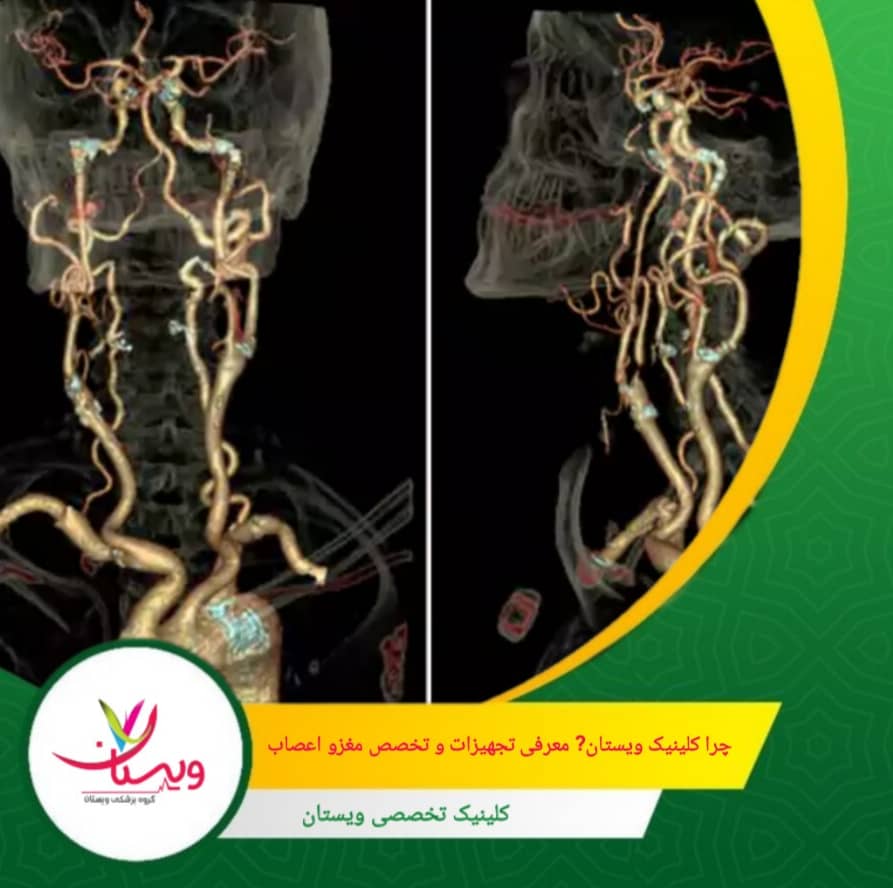 ویستان مجهز به دستگاههای سیتی آنژیوگرافی نسل جدید با قابلیت تصویربرداری سهبعدی و زمان اسکن کوتاه است، که باعث کاهش قابل توجه زمان انتظار و افزایش دقت تشخیص میشود. مقایسه ویستان با سایر مراکز تهران