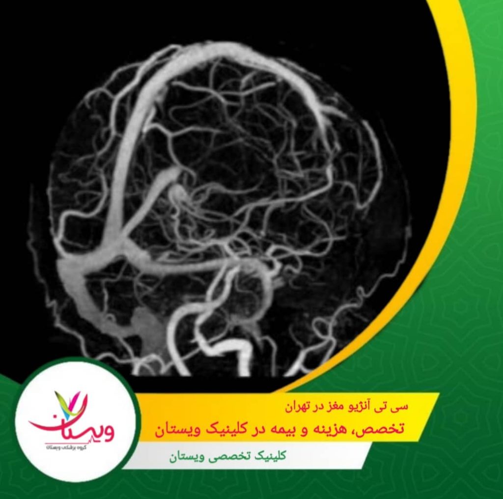 سی تی آنژیو مغز در تهران| تخصص، هزینه و بیمه درکلینیک ویستان