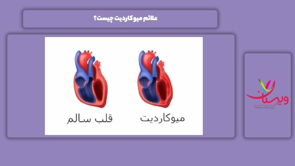 علامتهای میوکاردیت علائم میوکاردیت چیست؟