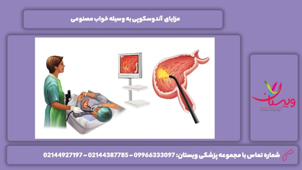 خوبیهای آندوسکوپی با خواب مصنوعی آندوسکوپی با خواب مصنوعی