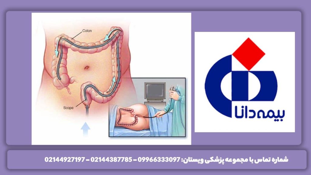 مزایای استفاده از بیمه دانا فواید انجام کولونوسکوپی با بیمه دانا