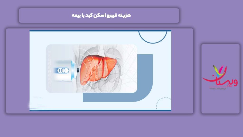 هزینه فیبرو اسکن با بیمه هزینه فیبرو اسکن کبد با بیمه
