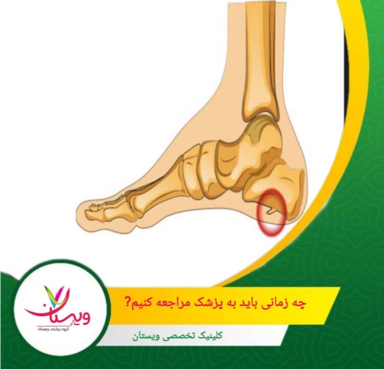 اگر درد پس از چند روز کاهش نیافت یا بدتر شد، ممکن است نشانهای از مشکل باشد. چه زمانی باید به پزشک مراجعه کنیم؟