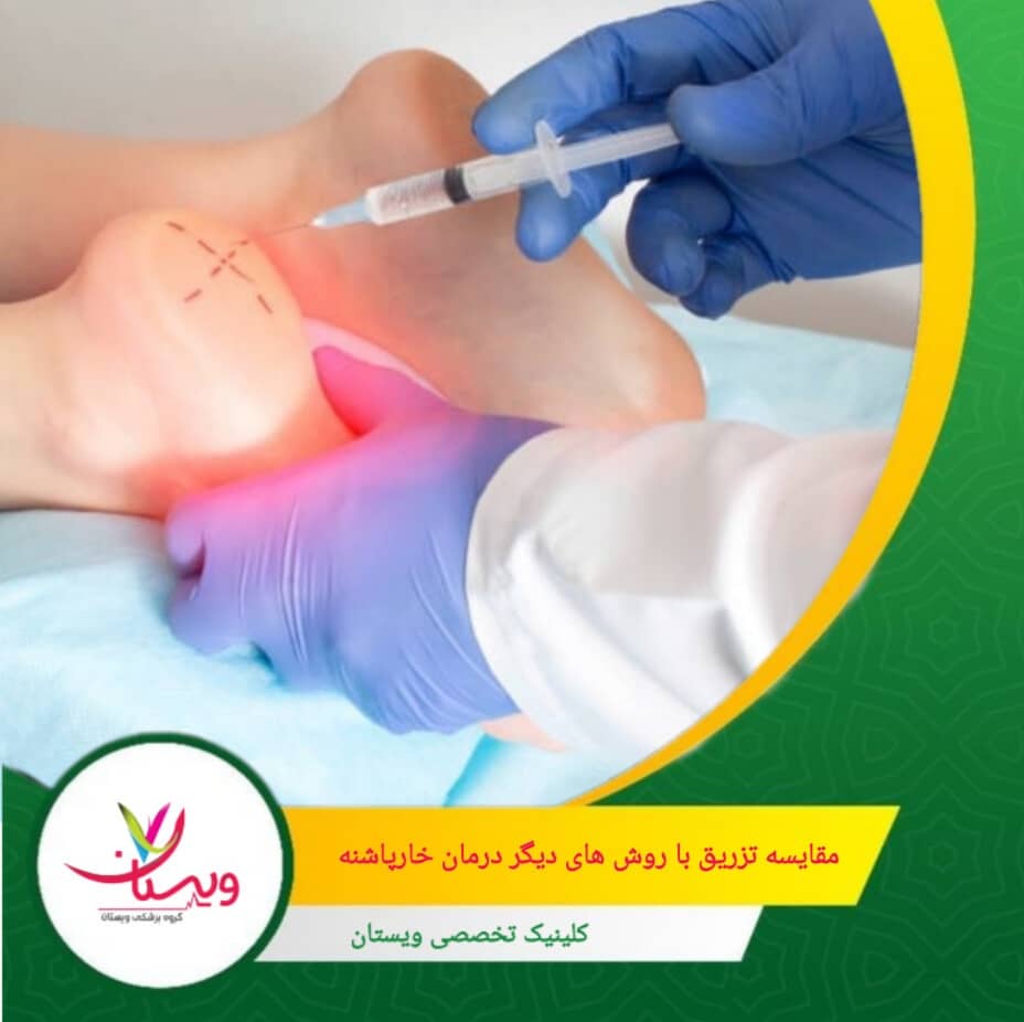 ممکن است نیاز به تکرار داشته باشد، خطر عوارض جانبی مانند ضعف بافتها از معایب تزریق خارپاشنه است. مقایسه تزریق با روشهای دیگر درمان خار پاشنه