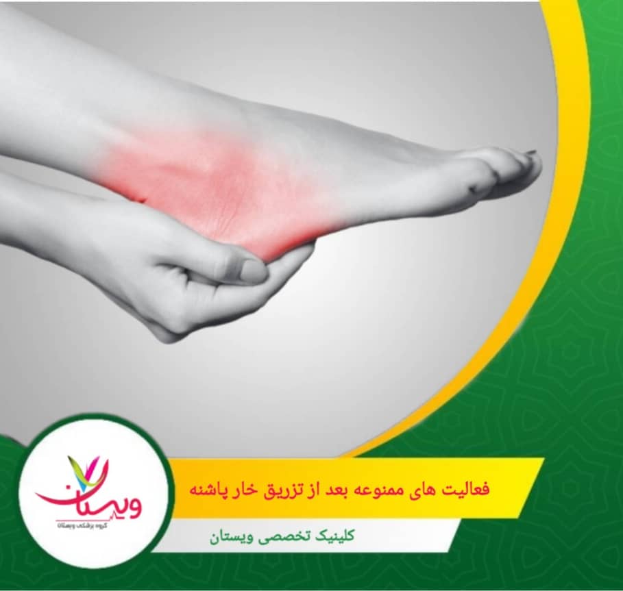 راه رفتن با پای برهنه، بهویژه روی سطوح سخت، میتواند فشار زیادی به پاشنه وارد کند. فعالیتهای ممنوعه بعد از تزریق خار پاشنه