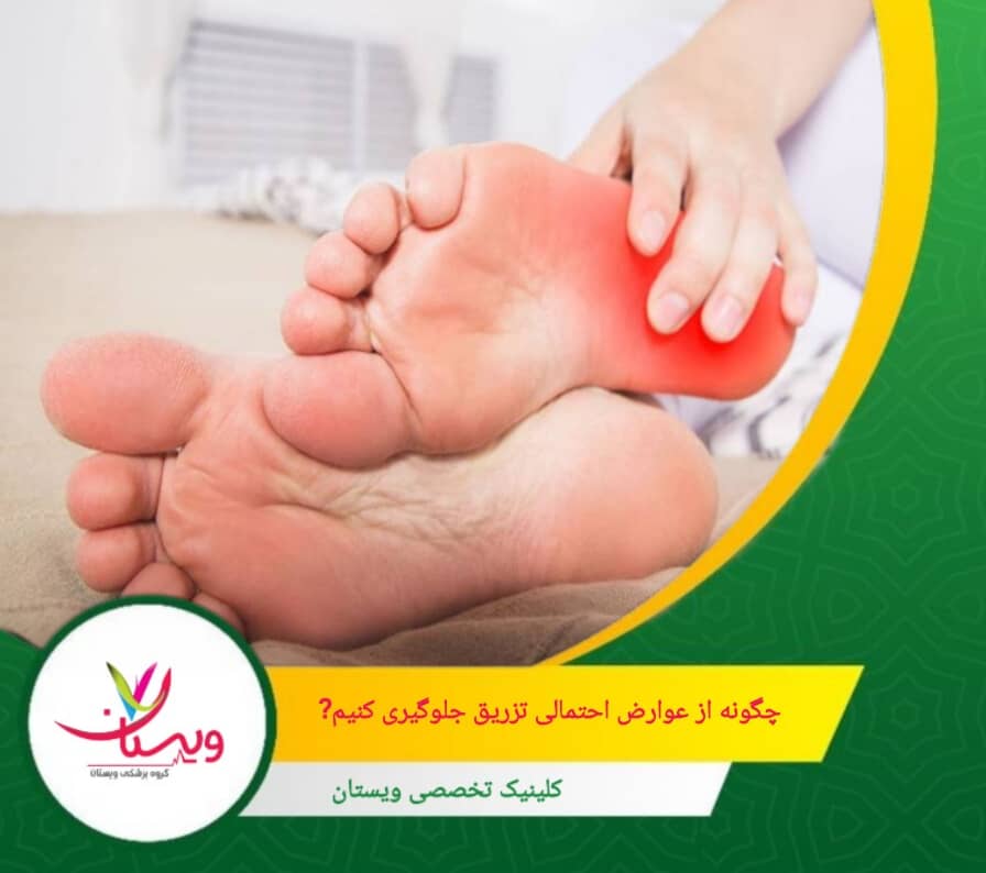از دویدن، پریدن یا هرگونه فعالیتی که فشار زیادی به پاشنه وارد میکند، خودداری کنید. چگونه از عوارض احتمالی تزریق جلوگیری کنیم؟
