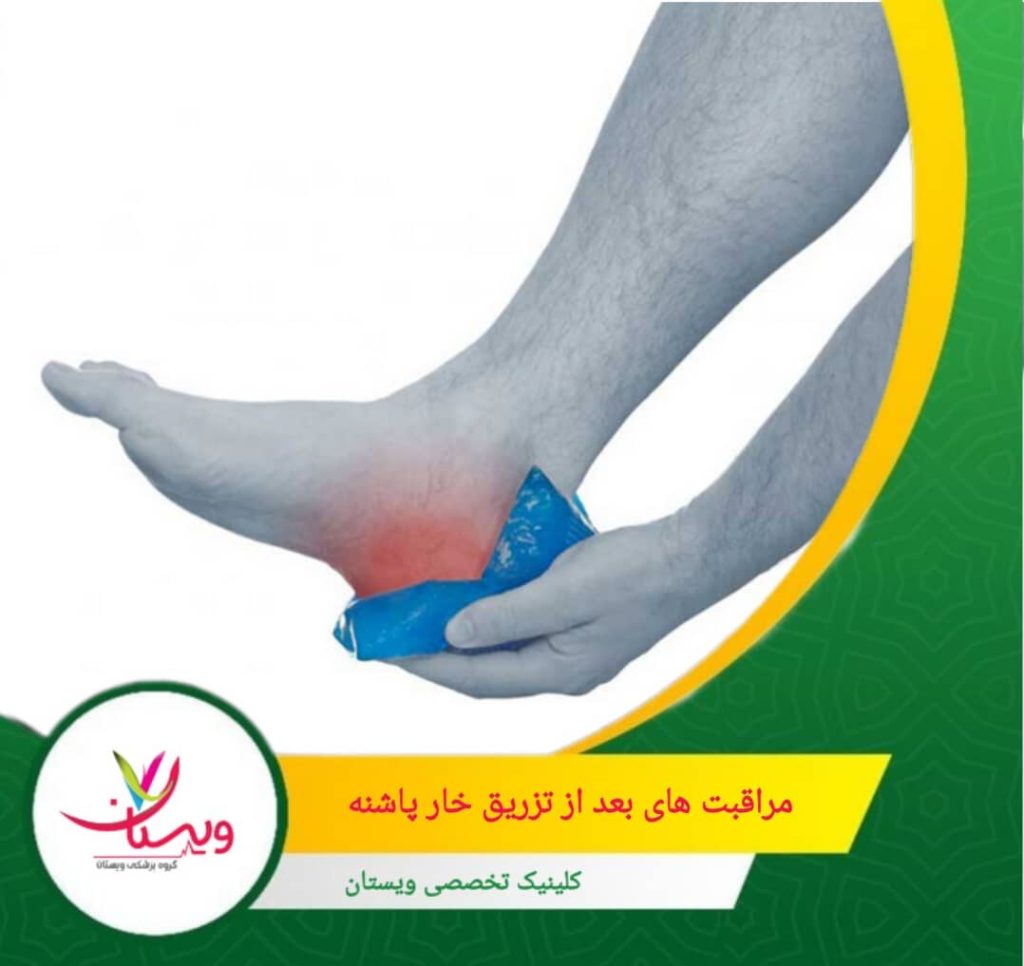 هنگام استراحت، پا را بالاتر از سطح قلب قرار دهید تا جریان خون بهتر شود و تورم کاهش یابد. مراقبتهای بعد از تزریق خار پاشنه