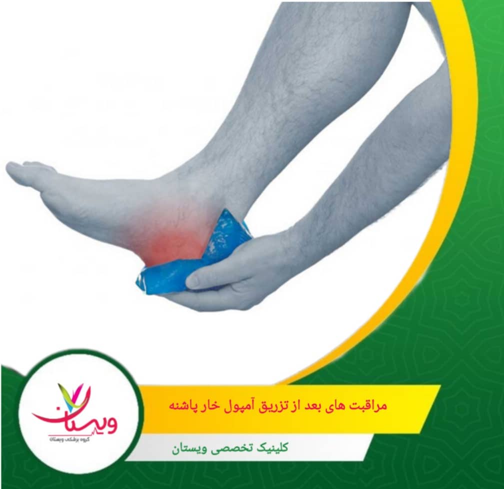 پس از بهبودی اولیه، تمرینات کششی ملایم برای تقویت عضلات و کاهش فشار روی پاشنه انجام دهید. مراقبتهای بعد از تزریق برای بهبود سریعتر