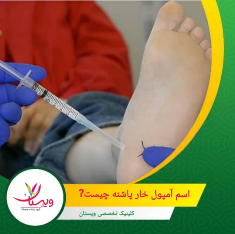 در این روش، گاز اوزون به ناحیه آسیبدیده تزریق میشود تا التهاب کاهش یابد و بهبودی تسریع شود. اسم آمپول خارپاشنه چیست؟