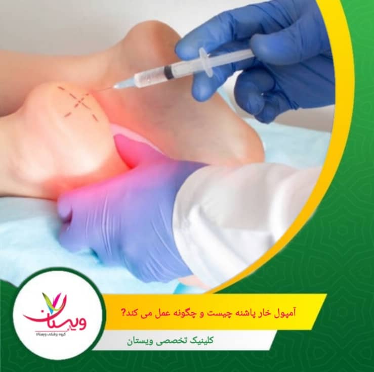 تزریق آمپول خارپاشنه میتواند به سرعت درد را کاهش دهد، اما این روش درمانی دائمی نیست. آمپول خارپاشنه چیست و چگونه عمل میکند؟