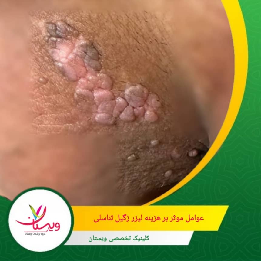 استفاده از دستگاههای پیشرفتهتر و مدرنتر، که دقت و کارایی بیشتری دارند، میتواند هزینه را افزایش دهد. عوامل موثر بر هزینه لیزر زگیل تناسلی