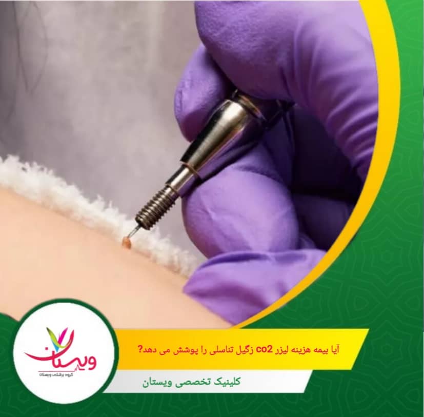 اگر درمان صرفاً به دلایل زیبایی انجام شود، احتمالاً تحت پوشش بیمه قرار نخواهد گرفت. آیا بیمه هزینه لیزر CO2 زگیل تناسلی را پوشش میدهد؟