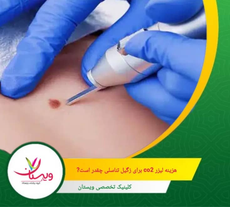 در کلینیک ویستان، ما با ارائه خدمات تخصصی و استفاده از تجهیزات مدرن، تجربهای مطمئن و رضایتبخش را برای شما فراهم میکنیم. هزینه لیزر CO2 برای زگیل تناسلی چقدر است؟