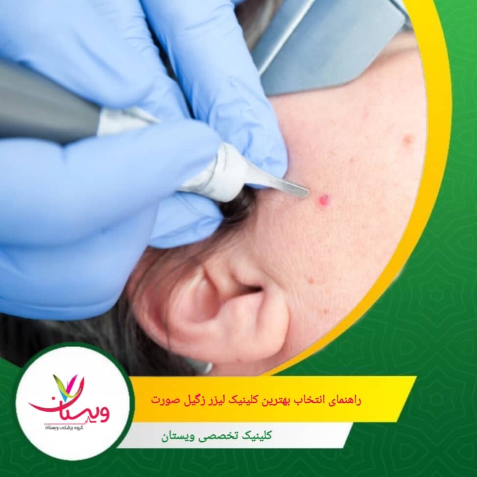 نظرات و تجربیات افرادی که قبلاً در کلینیک مورد نظر درمان شدهاند را بررسی کنید. این نظرات میتوانند دیدگاه واقعیتری از کیفیت خدمات ارائه دهند. راهنمای انتخاب بهترین کلینیک