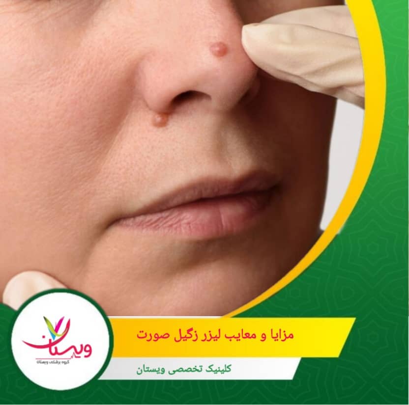 احتمال اسکار: ممکن است جای زخم کوچک باقی بماند. مزایا و معایب لیزر زگیل صورت