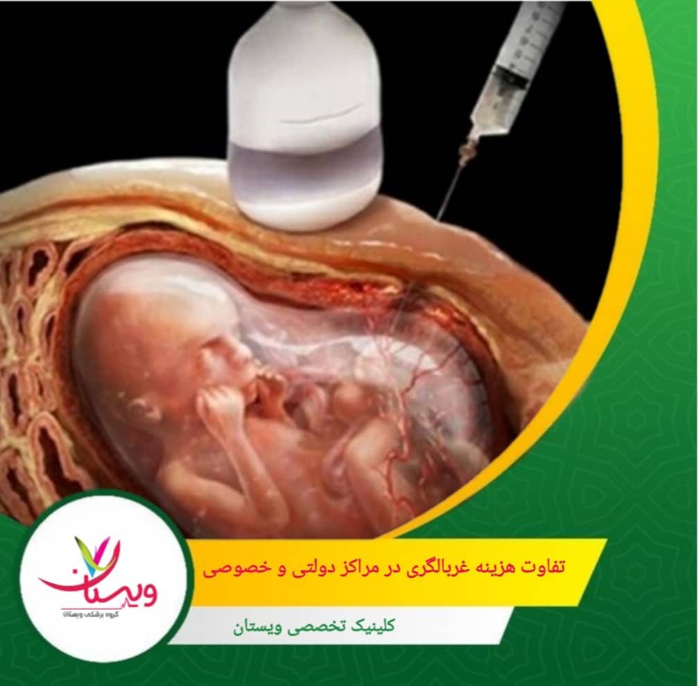 تفاوت هزینه غربالگری اول در مراکز دولتی و خصوصی