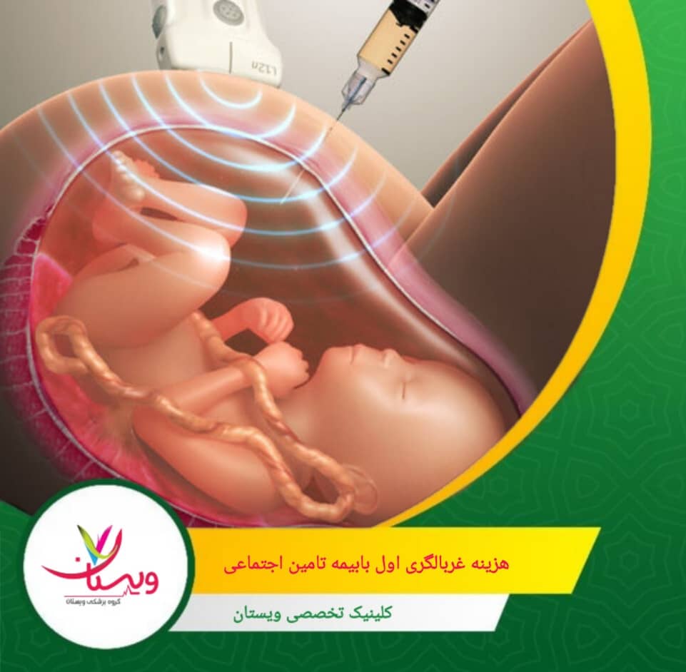هزینه غربالگری اول با بیمه تامین اجتماعی