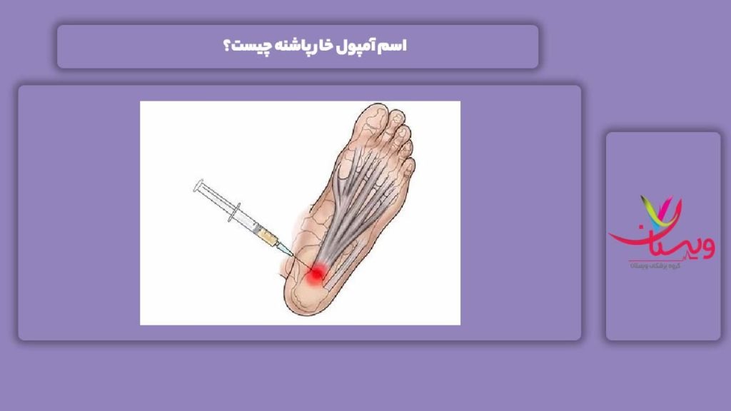 نام آمپول خار پاشنه قیمت آمپول خار پاشنه