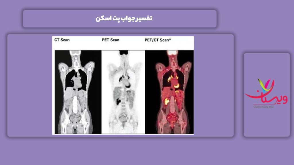 توضیح و شرح جواب این آزمایش تفسیر جواب پت اسکن