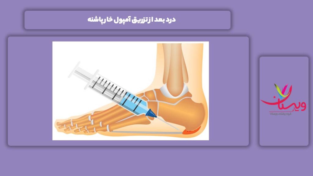 درد بعد انجام تزریق آمپول برای این مریضی درد بعد از تزریق آمپول خار پاشنه