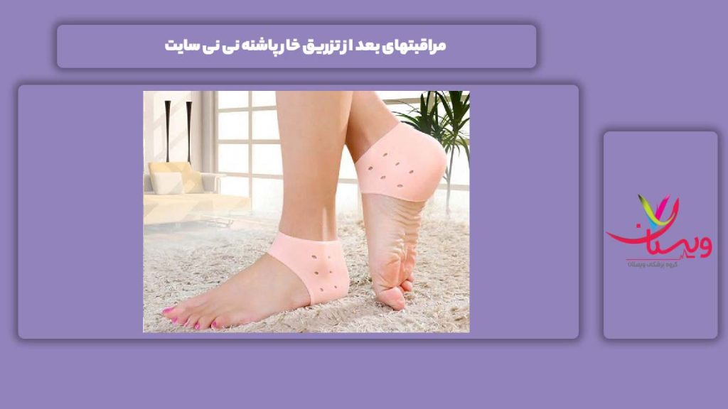 مراقبت بعد از تزریق مراقبتهای بعد از تزریق خار پاشنه نی نی سایت
