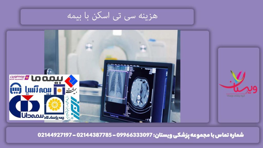 قیمت پرداختی CT Scan توسط بیمههای مختلف هزینه سی تی اسکن با پوشش دهی بیمه