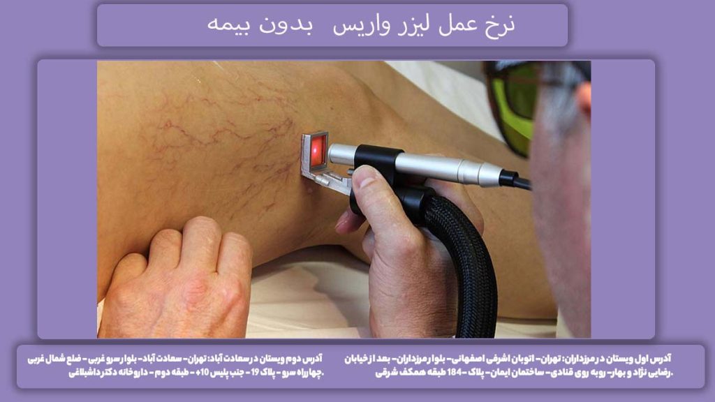 هزینه عمل آزاد قیمت خدمات لیزر درمانی
